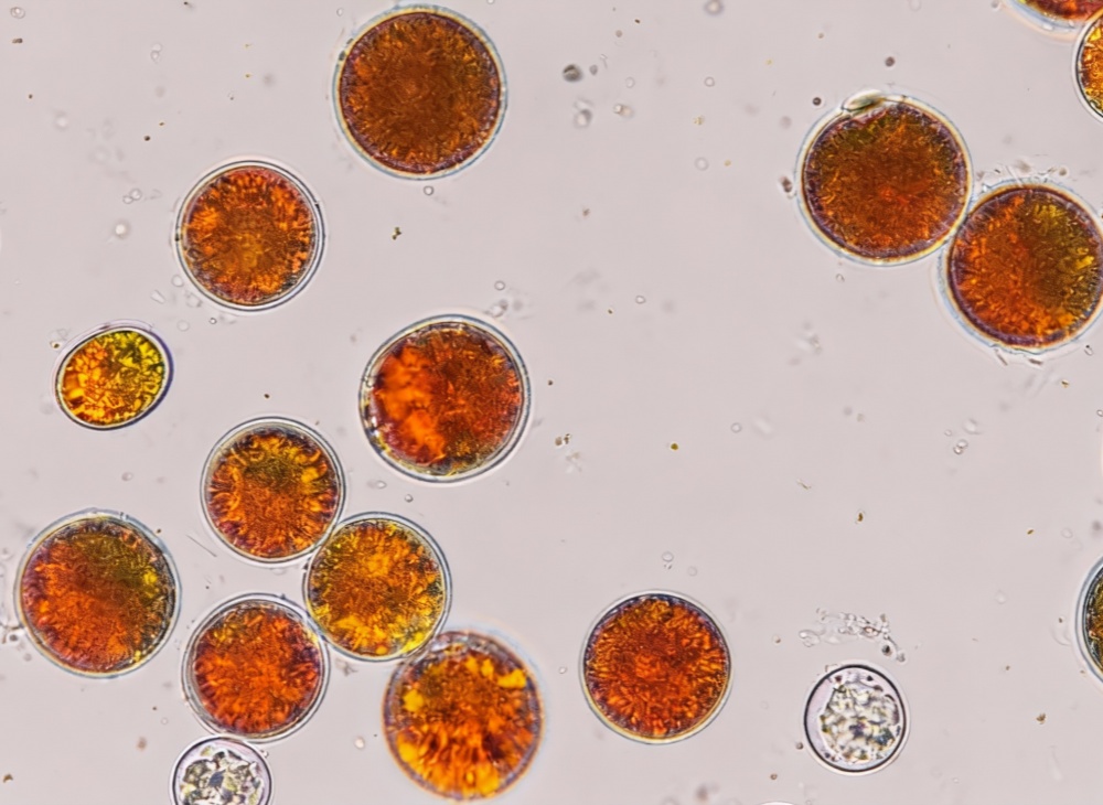 补充虾青素可以改善老年人群的认知健康